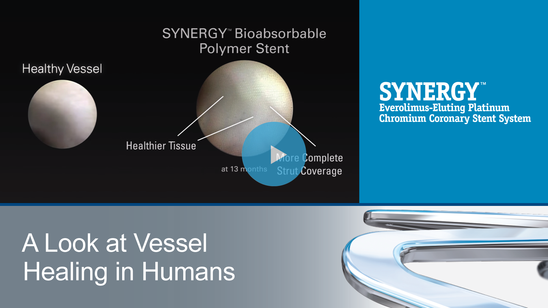 Bioabsorbable Polymer FAQs SYNERGY Stent Boston Scientific